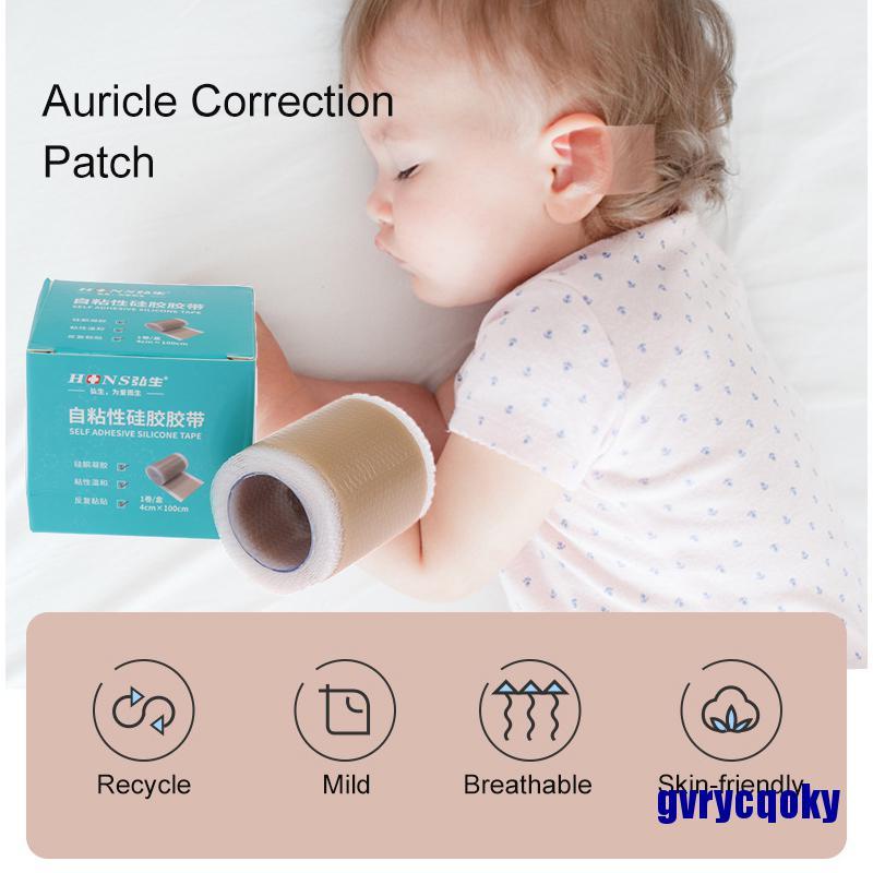 Vendaje corrector de oído Baby Auricle, corrección de orejas