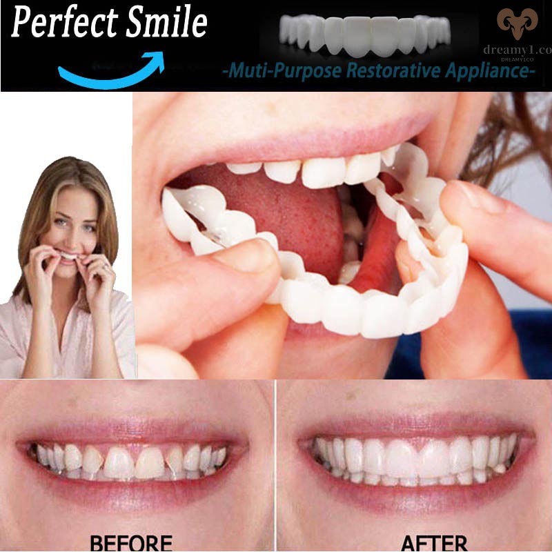 Dientes dentales temporales dientes perfectos falsos naturales y cómodos,  protegen tus dientes y recuperan una sonrisa segura (talla : 1)